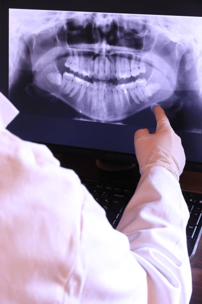 Best Emergency Wisdom Teeth Removal in Centuria, WI