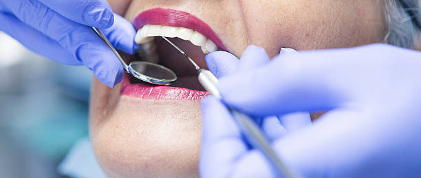 Best Emergency Wisdom Teeth Removal in Centuria, WI